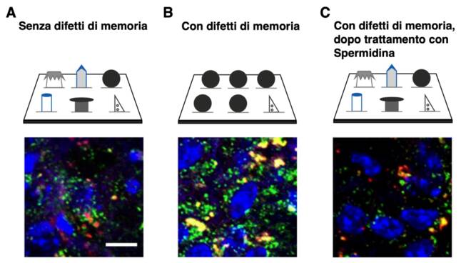 SPERMIDINA MEMORIA